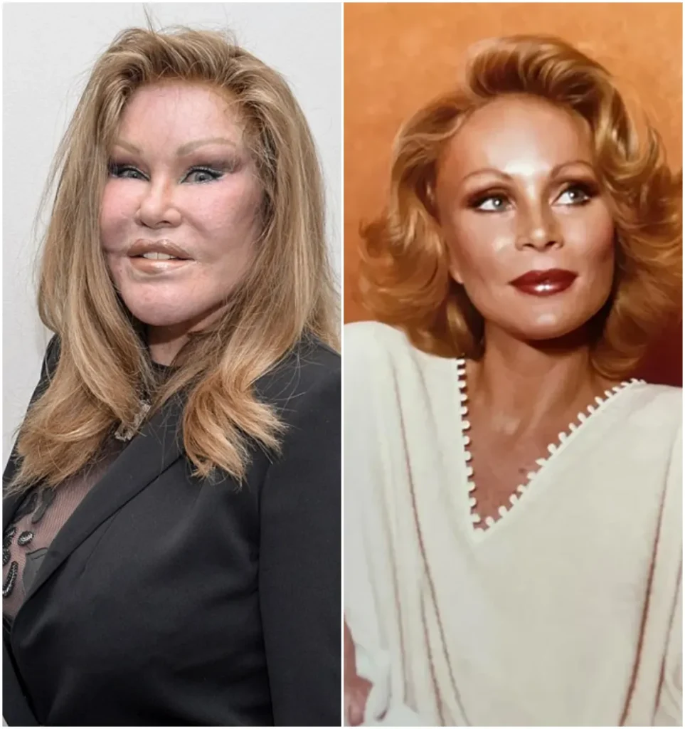 ‘Catwoman’ Jocelyn Wildenstein Shocks with Before and After Plastic Surgery Photos ‘Catwoman’ Jocelyn Wildenstein Shocks with Before and After Plastic Surgery Photos